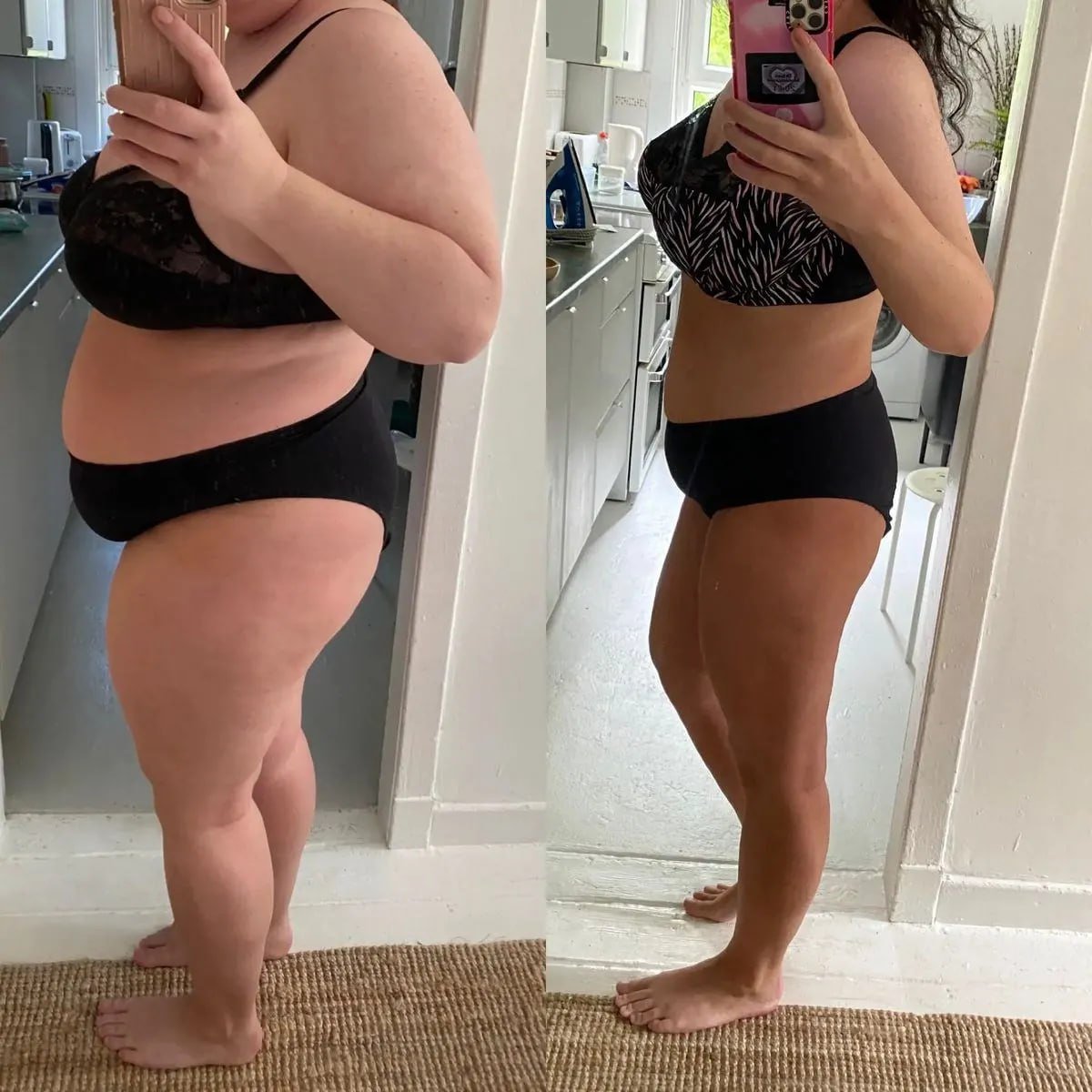 Before/after profile: Vanessa R. trims her waist with LipoVive