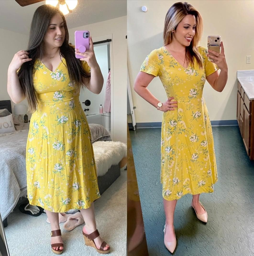 Before/after in yellow dress: Marina G. with LipoVive