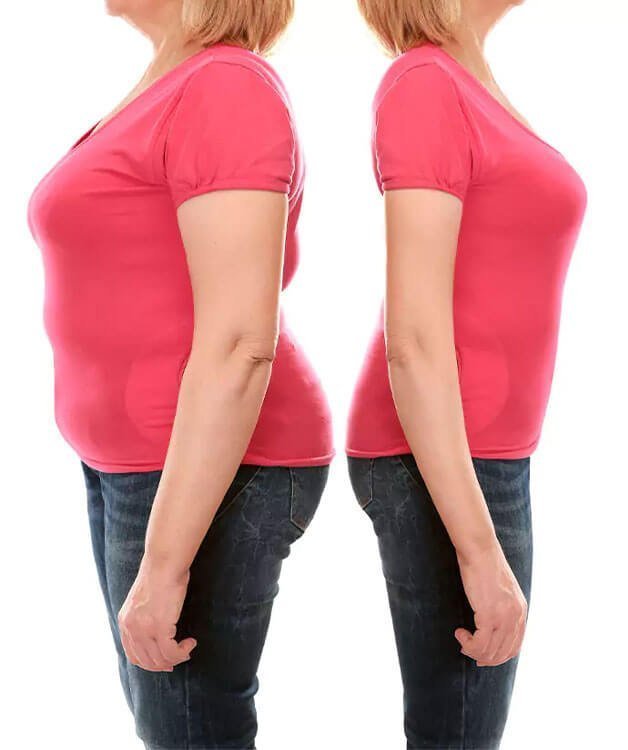 Add your before/after or product image here